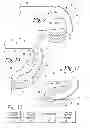 Fig. 04 - Medical instrument and method of performing a surgical procedure with the medical instrument