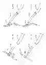 Fig. 167 - Robotic catheter system