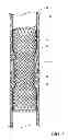 Fig. 03 - ENDOLUMINAL PROSTHESIS HAVING ANTI-MIGRATION COATING