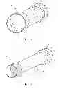 Fig. 04 - ENDOLUMINAL PROSTHESIS HAVING ANTI-MIGRATION COATING