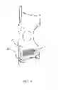Fig. 04 - BODY ARMOR STABILIZATION SYSTEM