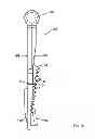 Fig. 17 - Trash cans with variable gearing assemblies