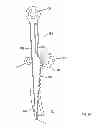 Fig. 21 - Trash cans with variable gearing assemblies