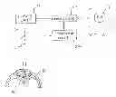 Fig. 01 - System and method with refractive corrections for controlled placement of a laser beam's focal point