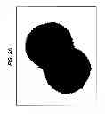 Fig. 09 - Developments in meningococcal outer membrane vesicles
