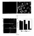 Fig. 07 - Nanotopography-mediated reverse uptake platform for nucleic acid delivery and applications thereof