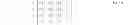 Fig. 02 - Otoscanning with 3D modeling