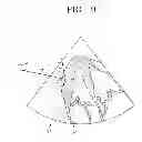 Fig. 07 - METHOD AND APPARATUS FOR OBTAINING MOVEMENT VELOCITY AND DIRECTION OF TISSUE