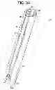 Fig. 06 - Instrument for compression and distraction
