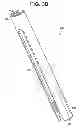 Fig. 07 - Instrument for compression and distraction