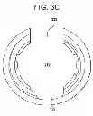 Fig. 08 - Instrument for compression and distraction