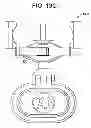 Fig. 35 - Instrument for compression and distraction