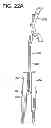 Fig. 77 - Instrument for compression and distraction