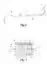 Fig. 02 - Suture retention devices and associated products and methods