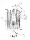 Fig. 03 - Suture retention devices and associated products and methods