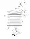 Fig. 04 - Suture retention devices and associated products and methods