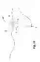 Fig. 09 - Suture retention devices and associated products and methods