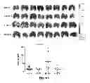 Fig. 07 - LMCD1 CANCER MARKERS AND METHODS FOR THEIR USE