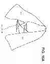 Fig. 33 - Convertible garment