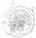 Fig. 01 - Inflation Support System for MR Guided HIFU