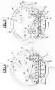 Fig. 04 - Inflation Support System for MR Guided HIFU