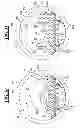 Fig. 07 - Inflation Support System for MR Guided HIFU