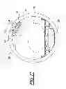 Fig. 10 - Inflation Support System for MR Guided HIFU