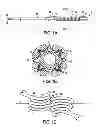 Fig. 02 - COLD-MOLDING PROCESS FOR LOADING A STENT ONTO A STENT DELIVERY SYSTEM