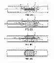 Fig. 08 - COLD-MOLDING PROCESS FOR LOADING A STENT ONTO A STENT DELIVERY SYSTEM
