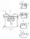 Fig. 02 - Acoustical device for drum