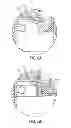 Fig. 07 - Resistive support mechanism