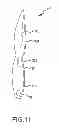 Fig. 10 - Kinetic flame device