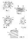Fig. 04 - Quick threaded rod locking devices and method