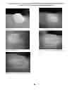Fig. 44 - Foamable formulation