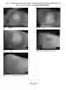 Fig. 46 - Foamable formulation