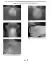 Fig. 49 - Foamable formulation