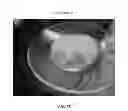 Fig. 76 - Foamable formulation