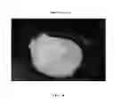 Fig. 79 - Foamable formulation