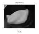 Fig. 85 - Foamable formulation