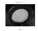 Fig. 86 - Foamable formulation