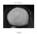 Fig. 87 - Foamable formulation