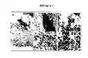 Fig. 16 - Cancer-associated antigen