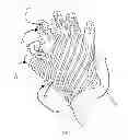 Fig. 02 - Medical Device to Aid in Ejaculation