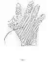 Fig. 04 - Medical Device to Aid in Ejaculation