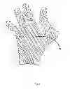 Fig. 05 - Medical Device to Aid in Ejaculation