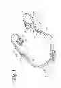 Fig. 02 - Bite Block Gag