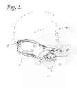 Fig. 03 - Bite Block Gag