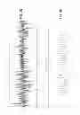 Fig. 30 - System and method for facilitating reflectometric detection of physiologic activity