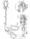 Fig. 02 - Apparatus and methods for occluding a hollow anatomical structure
