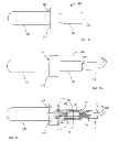 Fig. 08 - Vein Presentation Enhancement Device